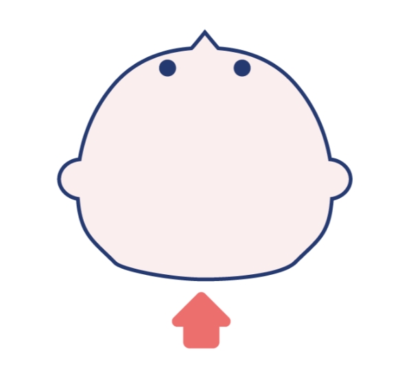 短頭症